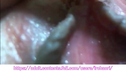 アジアン エンジェル 12036