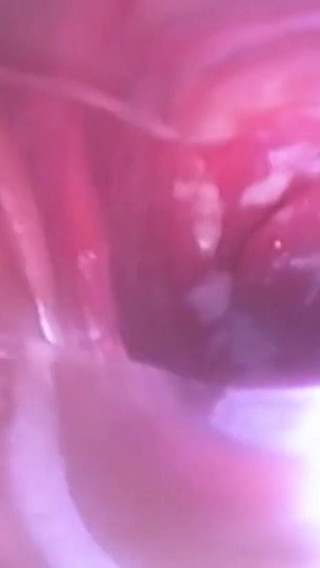 アジアン エンジェル 26650