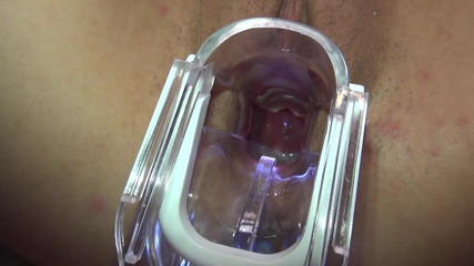 アジアの天使 14181