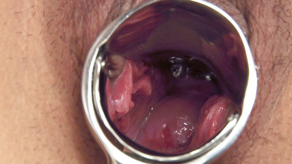 アジアの汗だくの広がりと振動